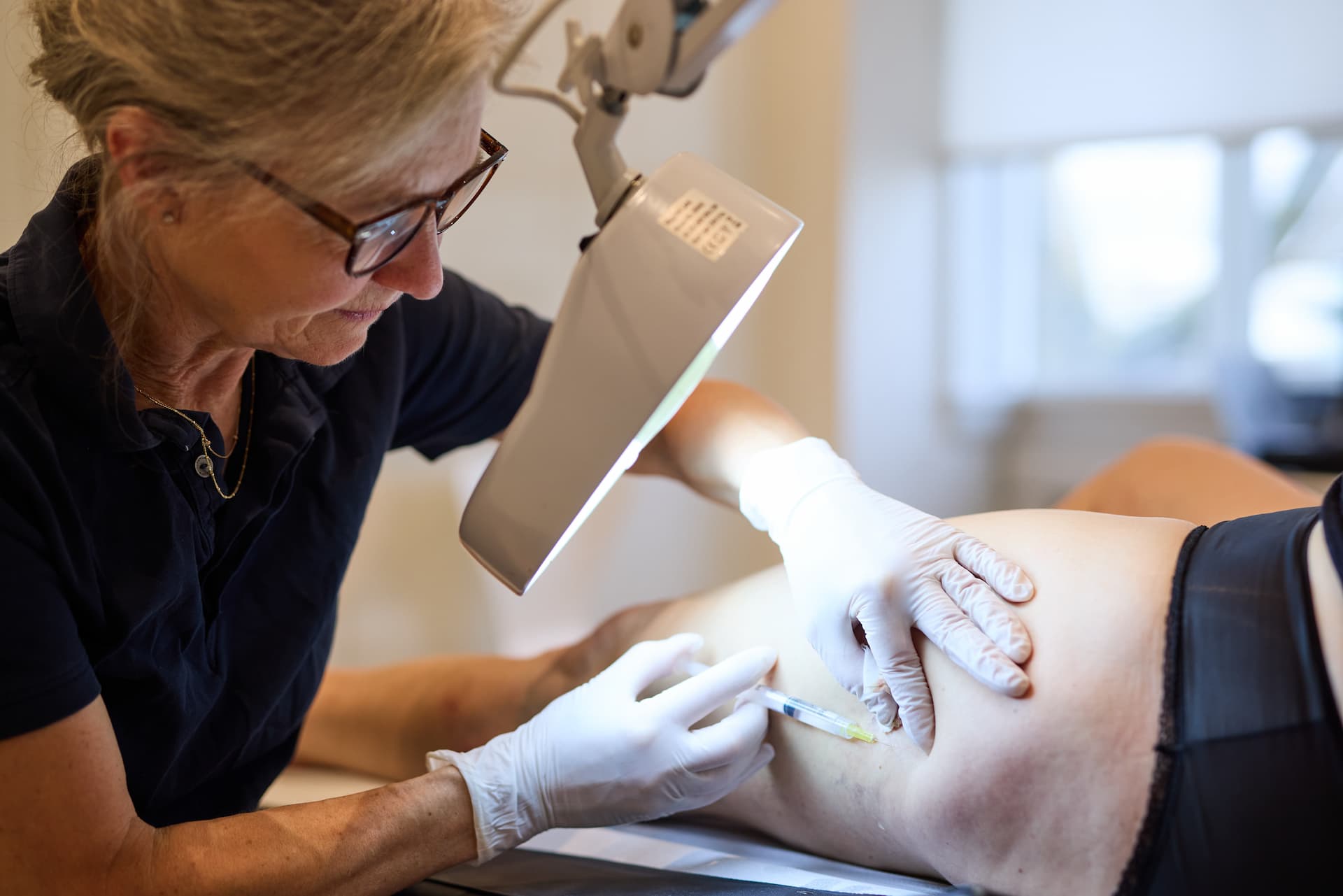 Billede af en behandling mod åreknuder